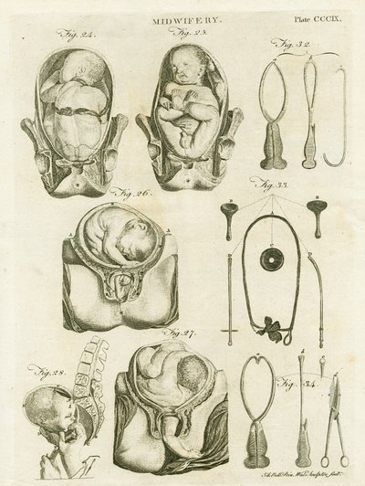 Obstétrique, illustration de 